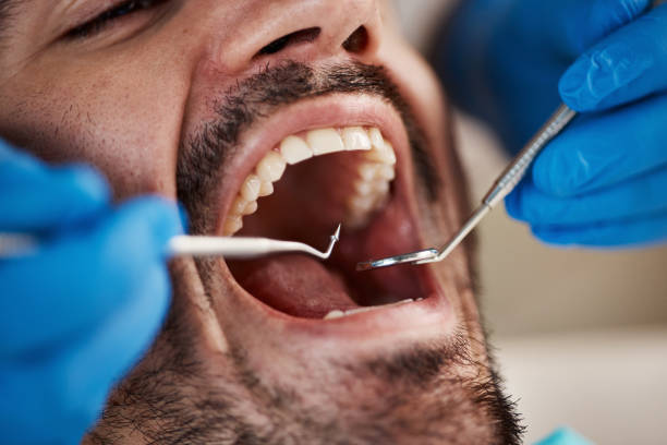 Best Walk-In Emergency Dental Services in Oakley, UT